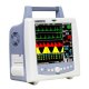Non-Invasive Blood Pressure Monitors Non-Invasive Blood Pressure Monitors